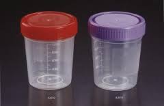 materiali di consumo medici dell'urina tazza sterile/non sterile da 60 ml per la raccolta del campione