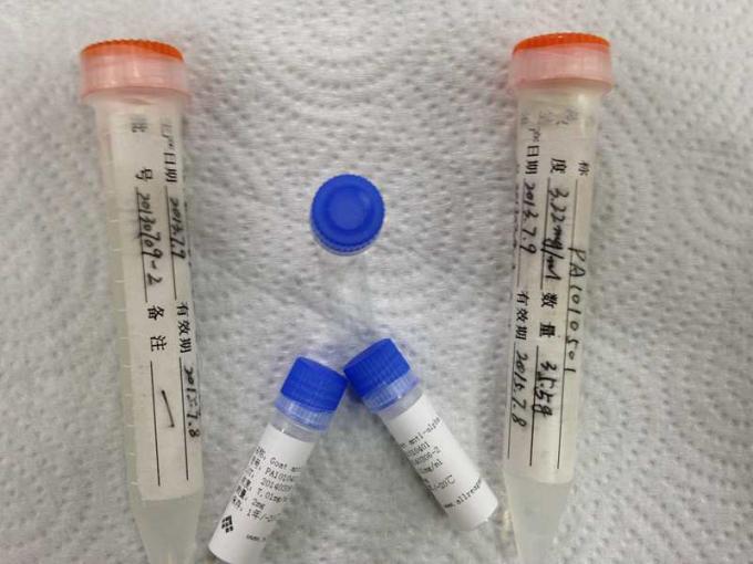 Anticorpo monoclonale di HBcAg del topo dell'ibridoma anti- di Mab per la fabbricazione di IVD