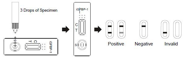 Il flusso laterale Immunochromatographic analizza la cassetta rapida della prova di AllTest iGFBP-1 nello scarico vaginale