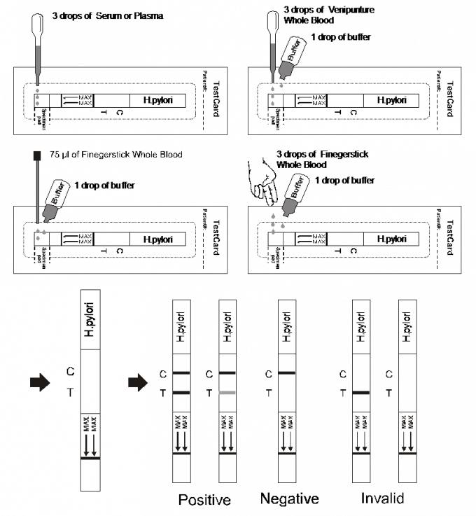 Il flusso laterale Immunochromatographic dell'anticorpo di H.pylori analizza le strisce, intero sangue/siero/plasma