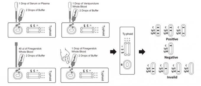 Accuratezza rapida tifoide dei corredi 96,5% della prova IgG/di IgM con la linea colorata (intero sangue/siero/plasma)
