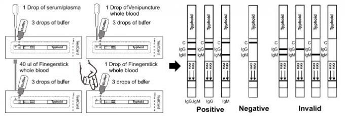 Asta misura-livello della prova/strisce rapide tifoidi (intero sangue/siero/plasma)