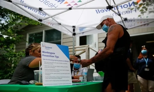 Latest company news about La risposta lenta a Monkeypox espone le agenzie sanitarie degli Stati Uniti come «stanche, sovraccarico»