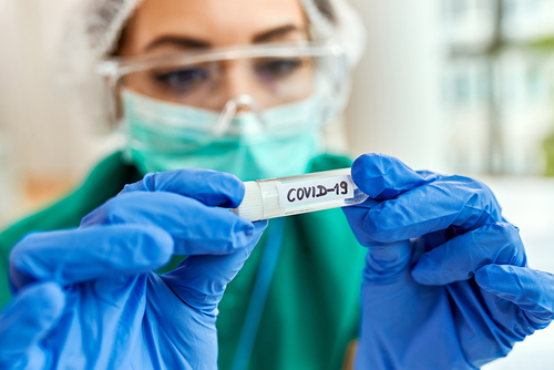 Latest company news about COVID: dovremmo temere una nuova ondata invernale di infezioni?