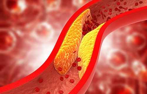 Ultime notizie aziendali su Decodificare il colesterolo: la strada per un corpo sano