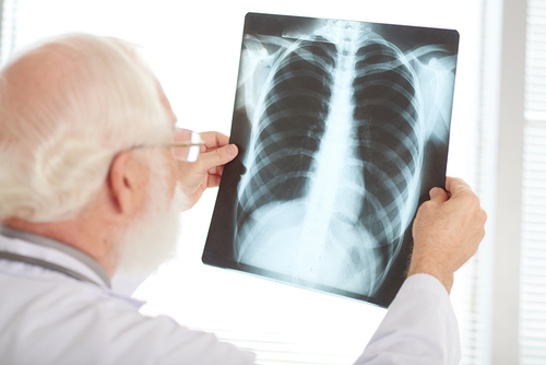 Ultime notizie aziendali su Per la prevenzione della tubercolosi, cosa dovremmo sapere?