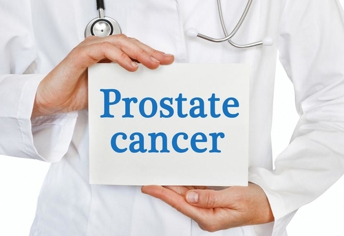 Ultime notizie aziendali su Il cancro alla prostata: una preoccupazione crescente per la salute degli uomini nel mondo