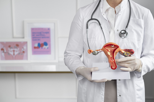 Ultime notizie aziendali su L'endometriosi è fortemente legata ad un elevato rischio di cancro ovarico