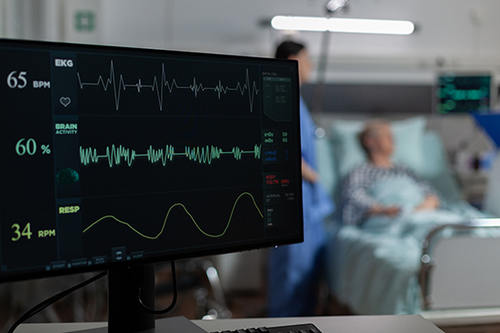 Ultimi blog aziendali su Comprendere la Fibrillazione Atriale (AFib)